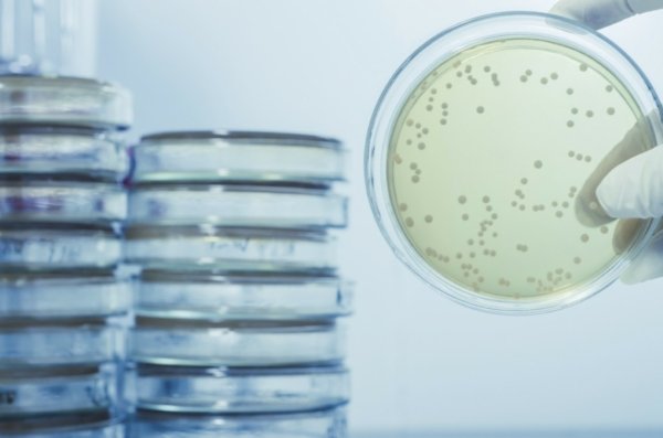 Basic Legionella Management